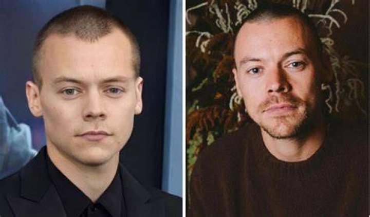 Bald Harry Styles in Black Suit and White Shirt