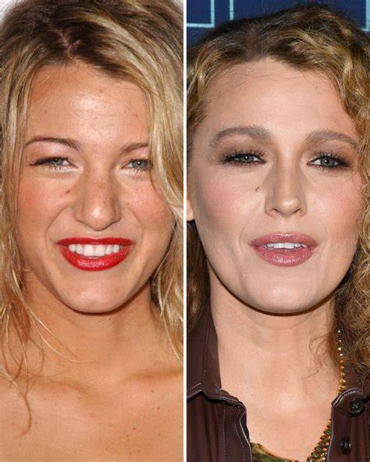 Blake Lively mostra antes e depois de nova gesta&ccedil;&atilde;o e brinca sobre