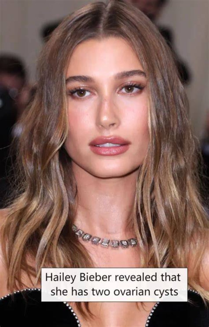 Hailey Bieber Has an Ovarian Cyst 'The Size of an Apple'&hellip;and It's Not