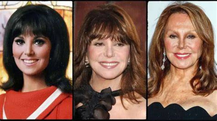 Has Marlo Thomas had Plastic Surgery Facelift Nose Job Plastic