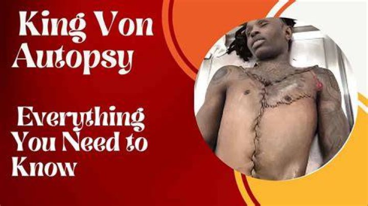 King Von Autopsy Tragic Examination November 6th, 2020