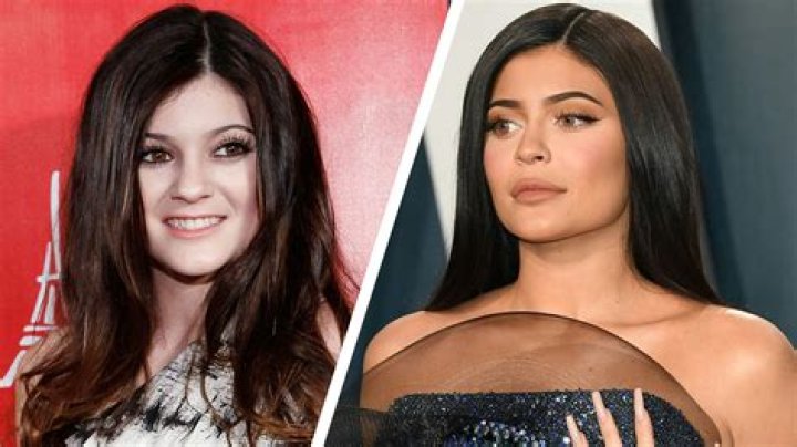 Kylie Jenner before and after her jawdropping transformation pics
