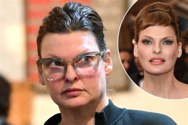 Linda Evangelista, 58, admits she STILL gets Botox despite a botched