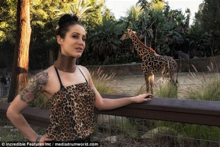 Sydney Smith Neck Stretched With Rings for Five Years Trendzified