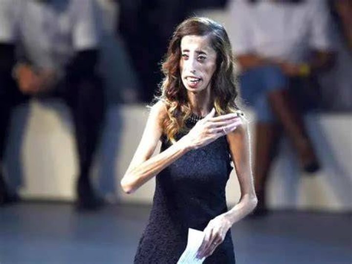 Top 10 Skinniest People In The World 2022 Kenyan Magazine