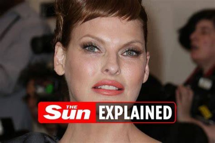 What did Linda Evangelista look like before and after CoolSculpting