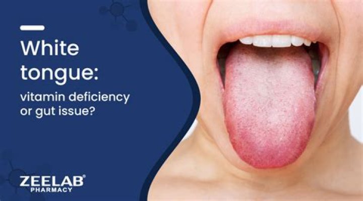 Which Vitamin Deficiency Causes White Spots on Skin? The Derm