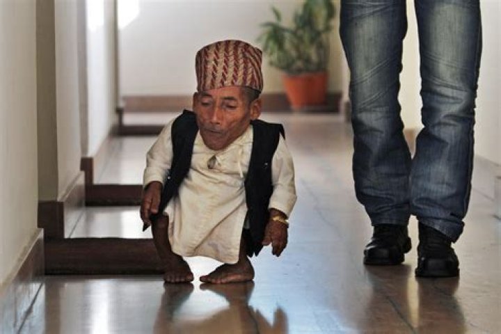 Worlds Smallest Person